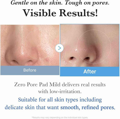 Medicube Zero Pore Pad 155g / 70 pads