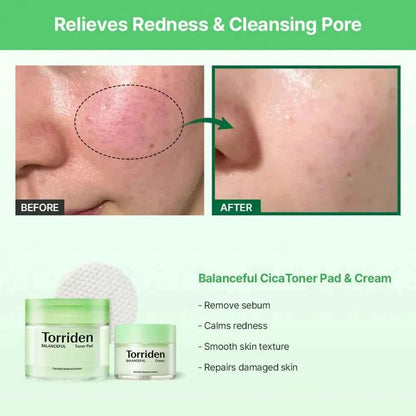 Torriden Balanceful Cica Toner Pad 180ml / 60pads